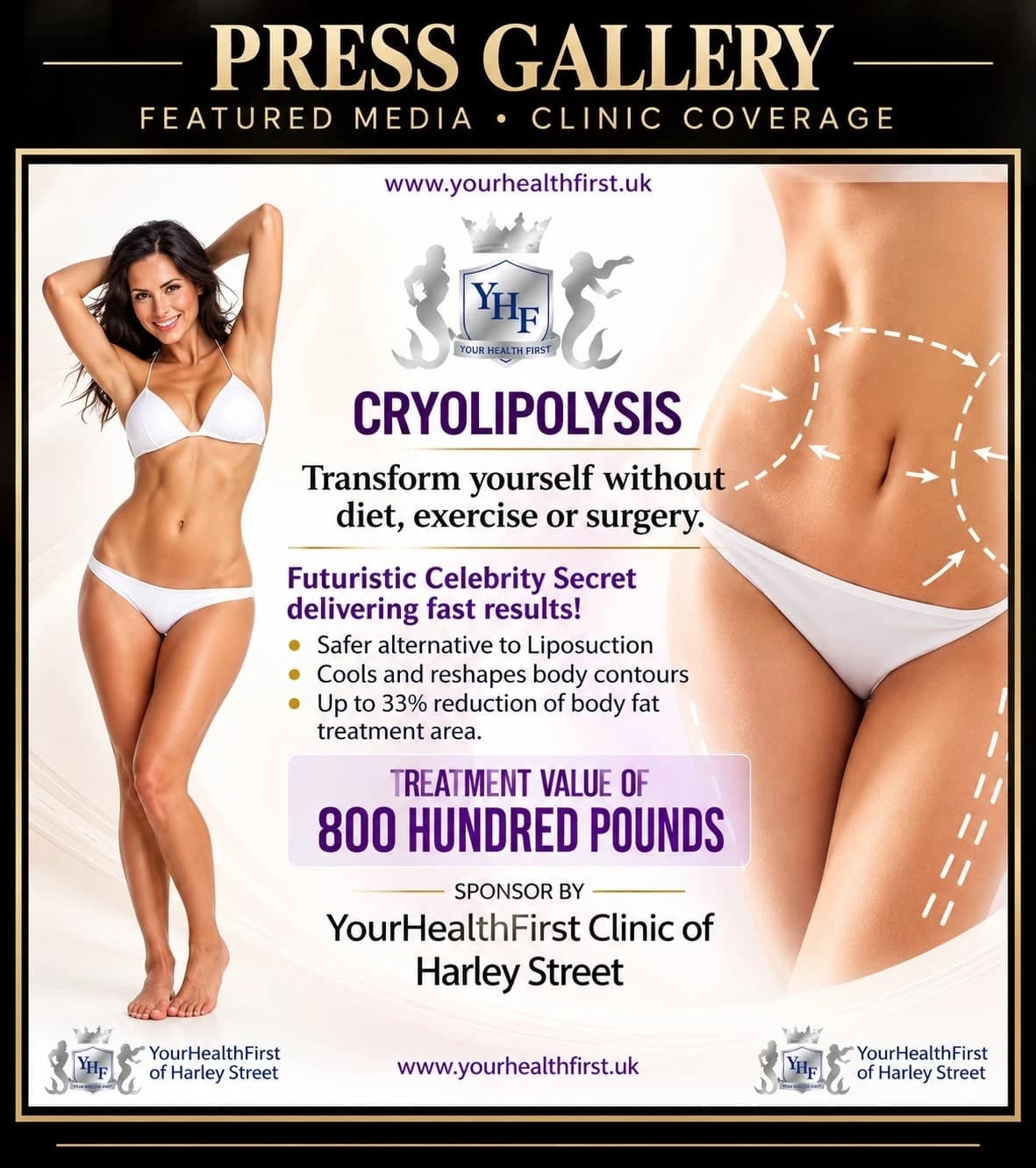 Cryolipolysis — featured media and clinic coverage, sponsored by YourHealthFirst Clinic of Harley Street