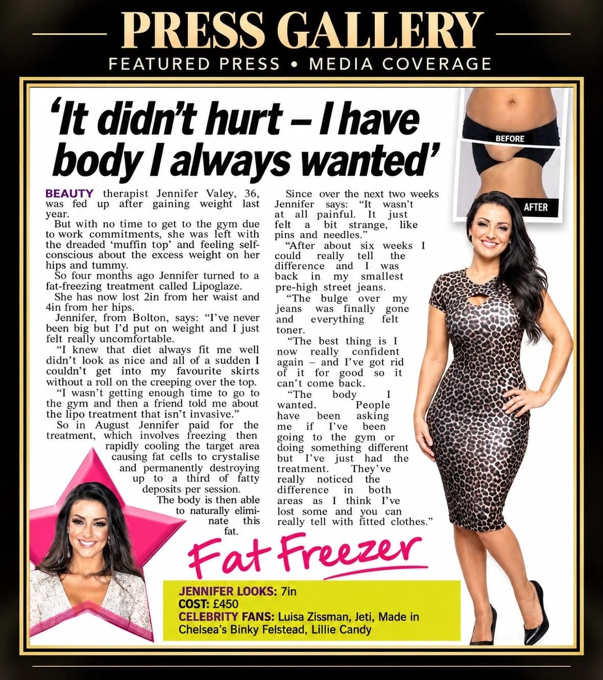 Fat Freezer — featured press coverage of fat-freezing treatment