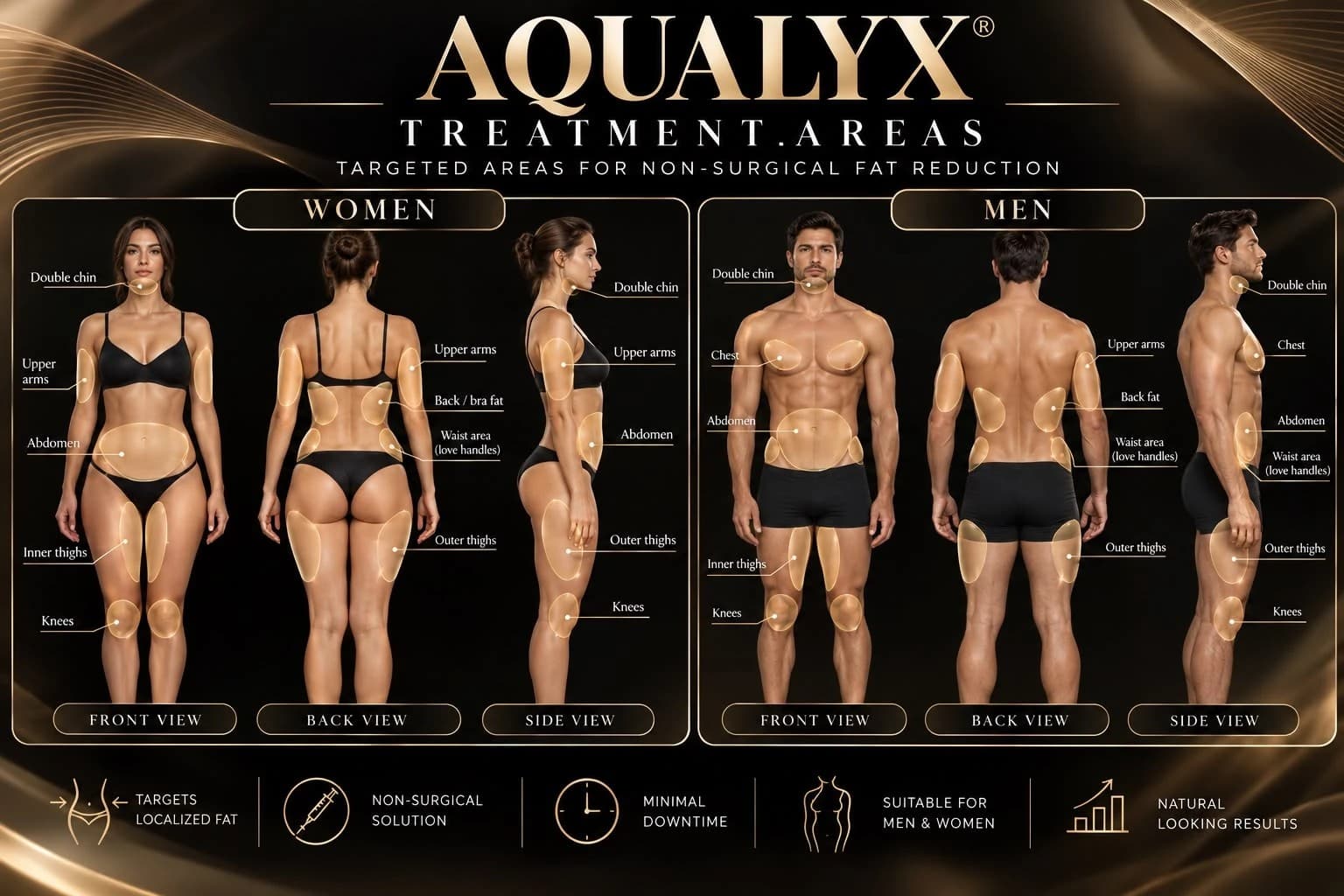 Aqualyx treatment areas for women and men — front, back and side views