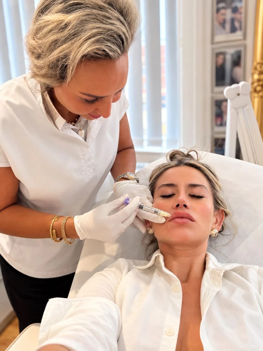 Lip enhancement with dermal filler at YourHealthFirst Clinic