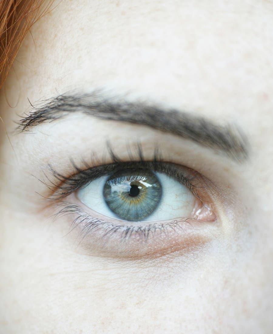 Close-up of the under-eye area