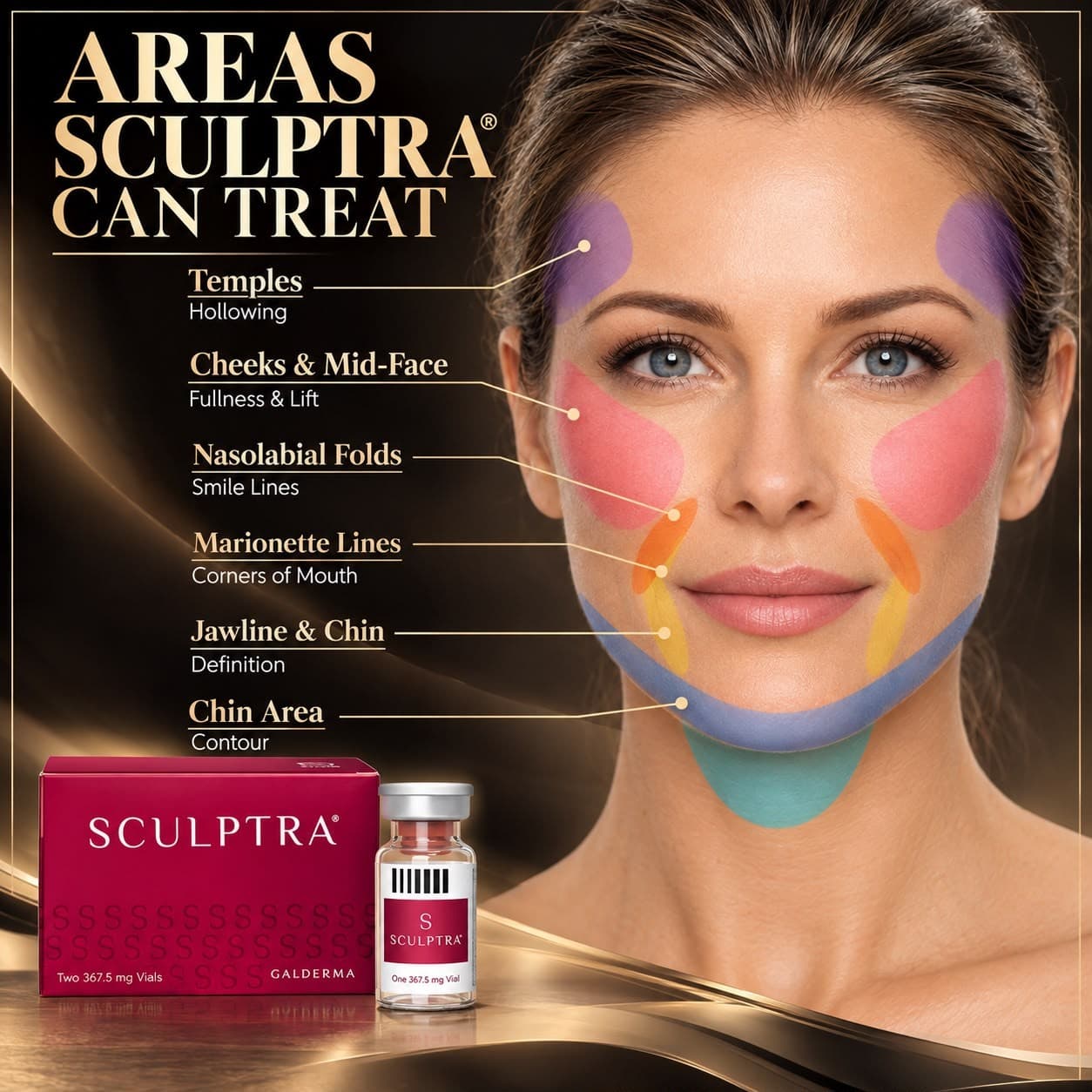 Areas Sculptra can treat — temples, cheeks & mid-face, nasolabial folds, marionette lines, jawline & chin, chin area