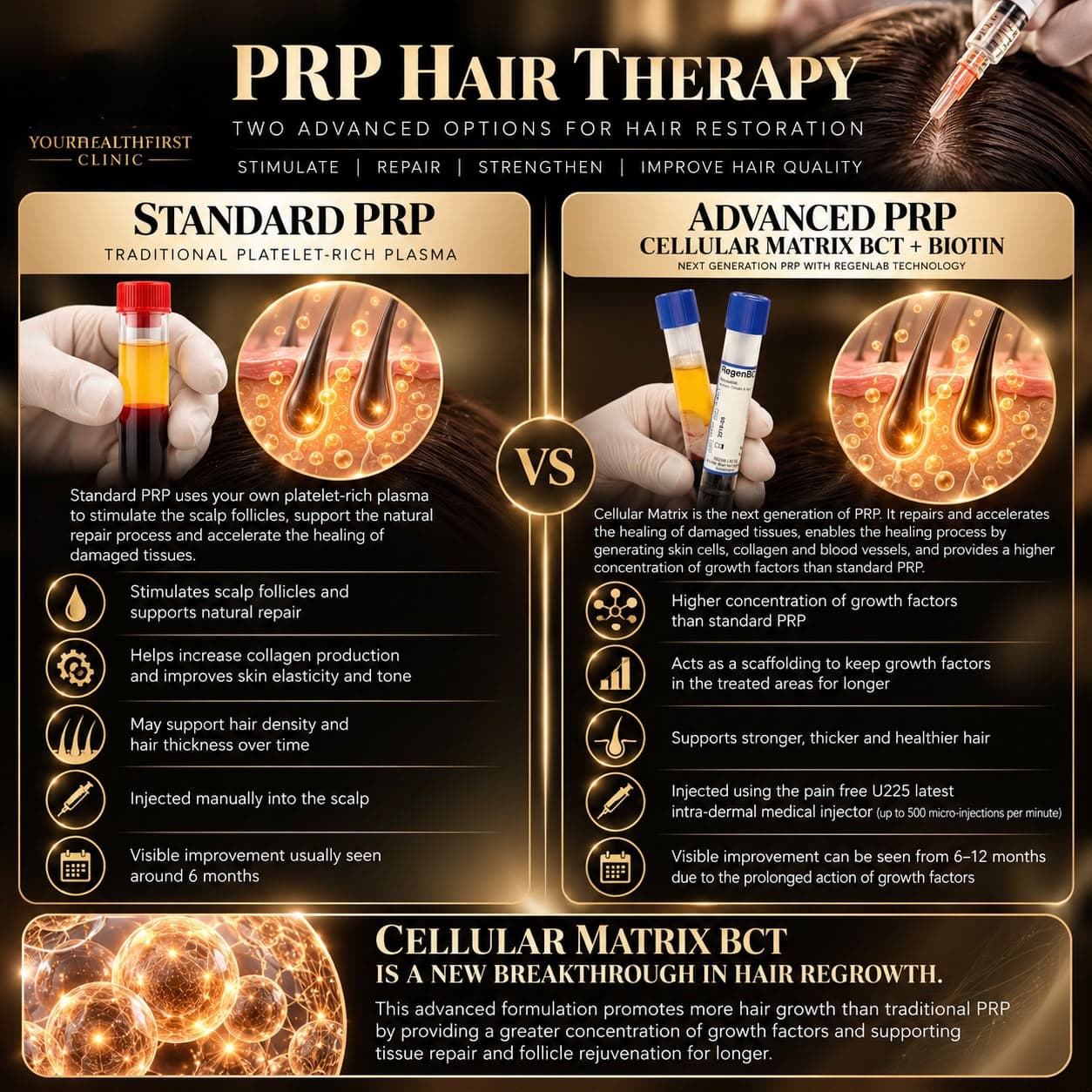 Manual PRP vs U225 PRP Injections comparison