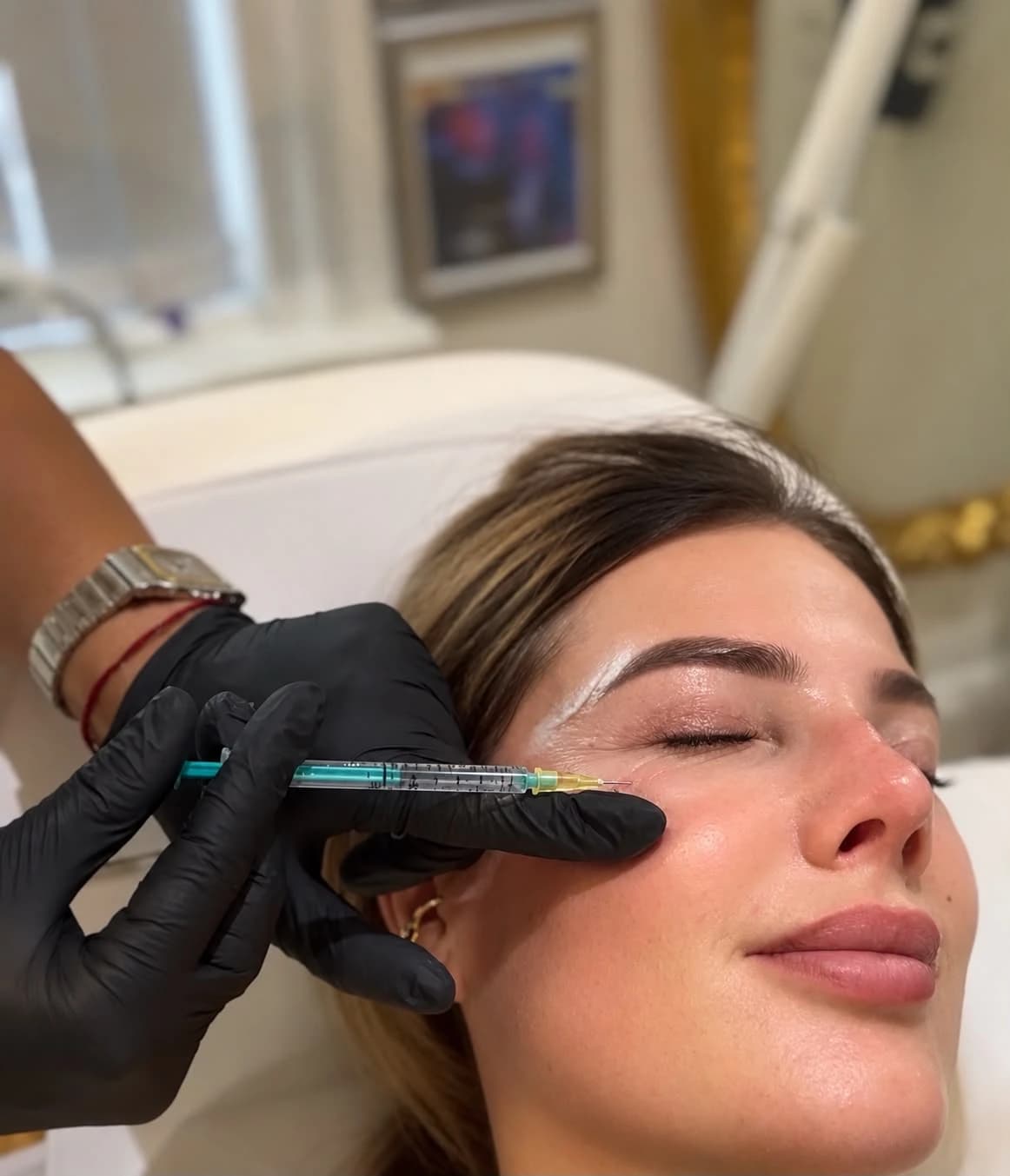 Precise anti-wrinkle injection around the eye area