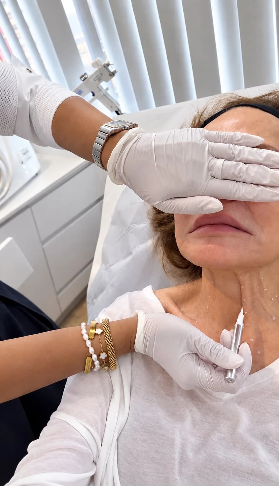 Anti-wrinkle treatment for platysmal bands on the neck
