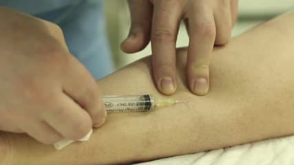 Sclerotherapy injection being administered to the leg